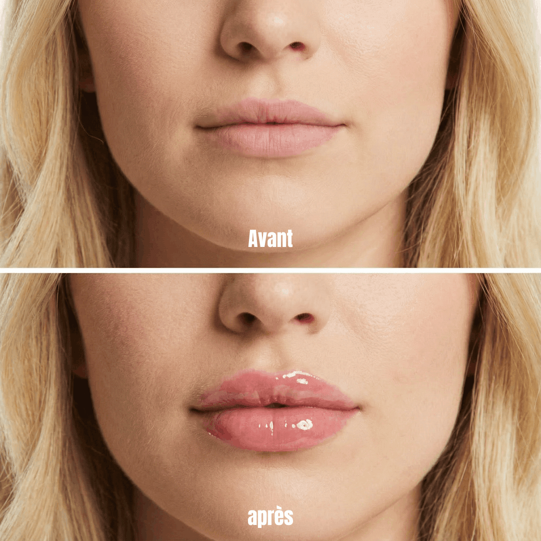 Avant après Lip Plumper Theyia - lèvres visiblement plus pulpeuses et hydratées
