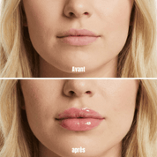 Avant après Lip Plumper Theyia - lèvres visiblement plus pulpeuses et hydratées