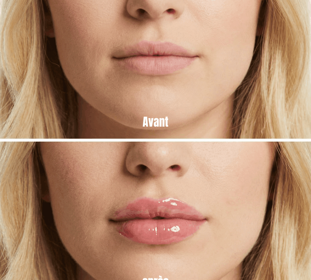 Avant après Lip Plumper Theyia - lèvres visiblement plus pulpeuses et hydratées